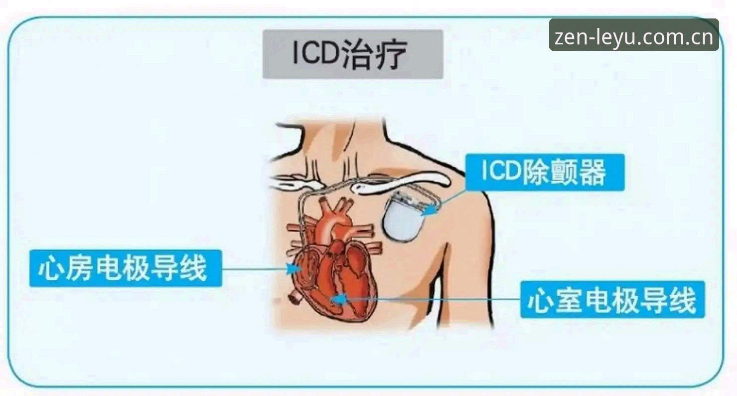 中国区leyu苹果版下载手机版 埃里克森五度晕倒:心脏除颤器真的撑得住高强度足球吗?——从乐鱼体育数据复盘一场被取消的热身赛